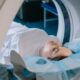 MRI and CT Scans